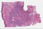 Digital Pathology